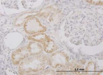 Immunohistochemistry-Paraffin: Protease Inhibitor 15 Antibody (3B5) [H00051050-M02]