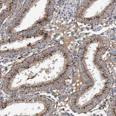 Immunohistochemistry-Paraffin: Protease Inhibitor 15 Antibody [NBP1-82444]