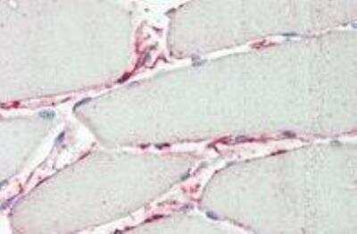 Immunohistochemistry-Paraffin: Protease Inhibitor 15 Antibody [NBP2-11581]