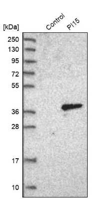 Western Blot: Protease Inhibitor 15 Antibody [NBP1-82445]