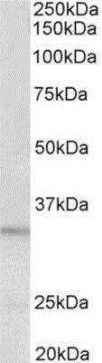 Western Blot: Protease Inhibitor 15 Antibody [NBP2-11581]