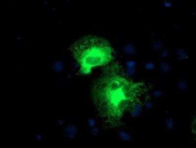 Immunocytochemistry/ Immunofluorescence: Proteasome 19S 10B Antibody (OTI1G6) [NBP2-00990]