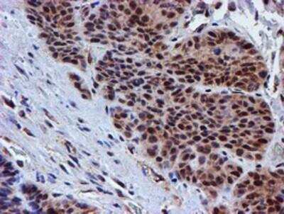 Immunohistochemistry-Paraffin: Proteasome 19S 10B Antibody (OTI1G6) [NBP2-00990]