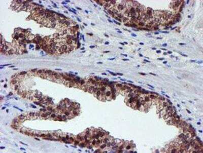 Immunohistochemistry-Paraffin: Proteasome 19S 10B Antibody (OTI1G6) [NBP2-00990]