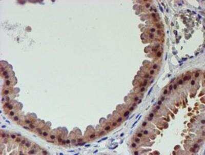 Immunohistochemistry-Paraffin: Proteasome 19S 10B Antibody (OTI1G6) [NBP2-00990]