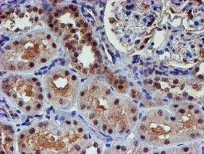 Immunohistochemistry-Paraffin: Proteasome 19S 10B Antibody (OTI1G6) [NBP2-00990]