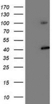 Western Blot: Proteasome 19S 10B Antibody (OTI1G6) [NBP2-00990]