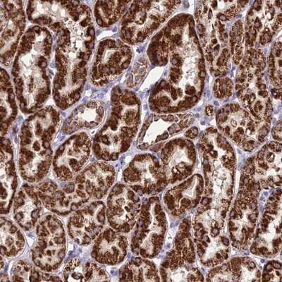 Immunohistochemistry-Paraffin: Proteasome 19S 10B Antibody [NBP1-92291]