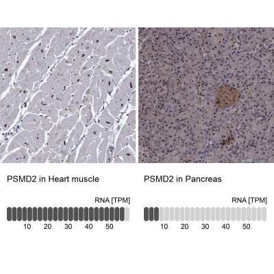 Immunohistochemistry-Paraffin: Proteasome 19S 10B Antibody [NBP3-17019]