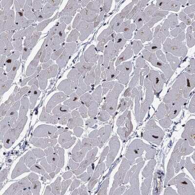Immunohistochemistry-Paraffin: Proteasome 19S 10B Antibody [NBP3-17019]