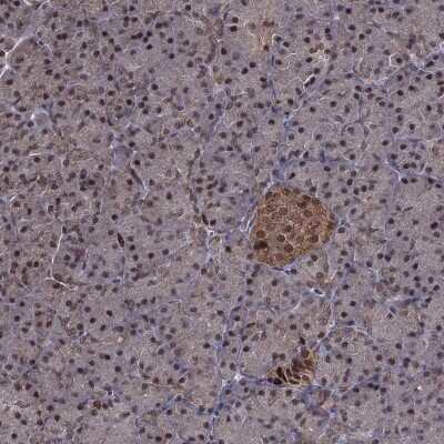 Immunohistochemistry-Paraffin: Proteasome 19S 10B Antibody [NBP3-17019]