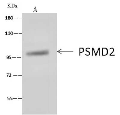 Immunoprecipitation: Proteasome 19S 10B Antibody [NBP2-99616]