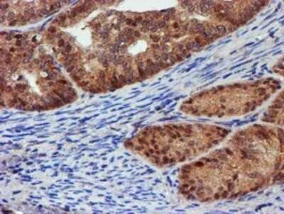 Immunohistochemistry: Proteasome 19S 10B Antibody (OTI1G6) - Azide and BSA Free [NBP2-73627]