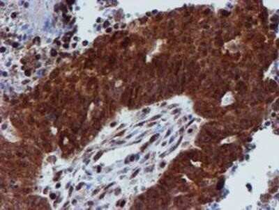 Immunohistochemistry: Proteasome 19S 10B Antibody (OTI1G6) - Azide and BSA Free [NBP2-73627]