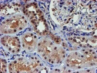 Immunohistochemistry: Proteasome 19S 10B Antibody (OTI1G6) - Azide and BSA Free [NBP2-73627]