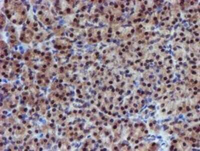 Immunohistochemistry: Proteasome 19S 10B Antibody (OTI1G6) - Azide and BSA Free [NBP2-73627]