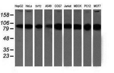 Western Blot: Proteasome 19S 10B Antibody (OTI1G6)Azide and BSA Free [NBP2-73627]