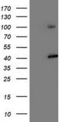 Western Blot: Proteasome 19S 10B Antibody (OTI1G6)Azide and BSA Free [NBP2-73627]