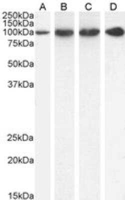 Western Blot: Proteasome 19S 10B Antibody [NB100-1483]