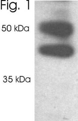 Western Blot: Proteasome 19S 10B Antibody [NB300-532]