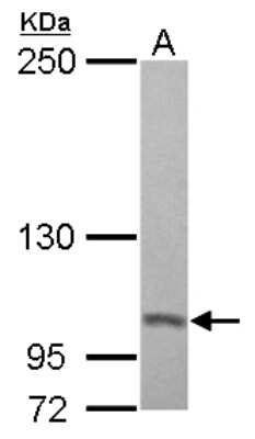 Western Blot: Proteasome 19S 10B Antibody [NBP2-19950]