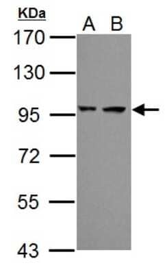 Western Blot: Proteasome 19S 10B Antibody [NBP2-19950]