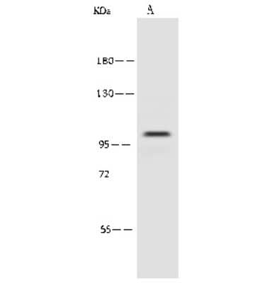 Western Blot: Proteasome 19S 10B Antibody [NBP2-99616]