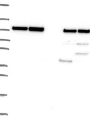 Western Blot: Proteasome 19S 10B Antibody [NBP3-17019]