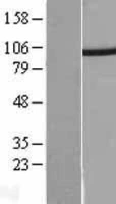 Western Blot: Proteasome 19S 10B Overexpression Lysate [NBL1-14900]