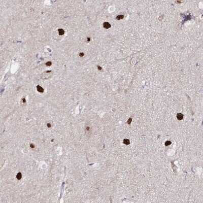 Immunohistochemistry: Proteasome 19S S3 Antibody [NBP2-38596]