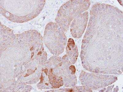 Immunohistochemistry-Paraffin: Proteasome 19S S3 Antibody [NBP1-31530]