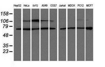 Western Blot: Proteasome 19S S3 Antibody (OTI2A2)Azide and BSA Free [NBP2-73636]