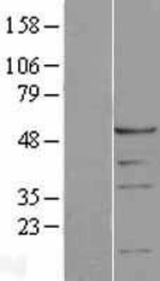 Western Blot: PSMC1 Overexpression Lysate [NBL1-14886]