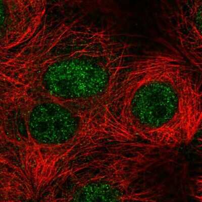 Immunocytochemistry/ Immunofluorescence: S5a/Angiocidin Antibody [NBP1-90821]