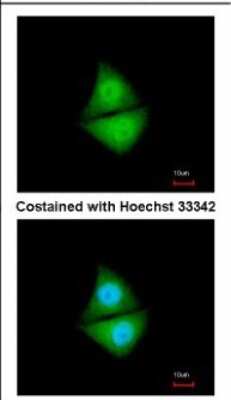 Immunocytochemistry/ Immunofluorescence: S5a/Angiocidin Antibody [NBP2-19952]