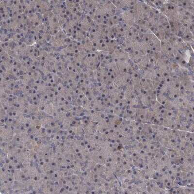 Immunohistochemistry-Paraffin: S5a/Angiocidin Antibody [NBP1-90821]
