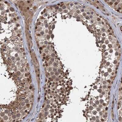 Immunohistochemistry-Paraffin: S5a/Angiocidin Antibody [NBP1-90821]