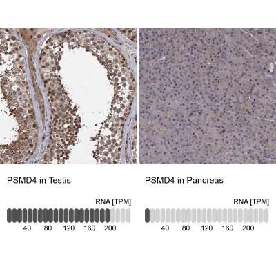 Immunohistochemistry-Paraffin: S5a/Angiocidin Antibody [NBP1-90821]