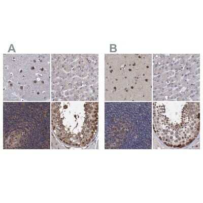 Immunohistochemistry-Paraffin: S5a/Angiocidin Antibody [NBP1-90821]