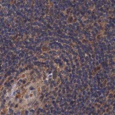Immunohistochemistry-Paraffin: S5a/Angiocidin Antibody [NBP1-90821]
