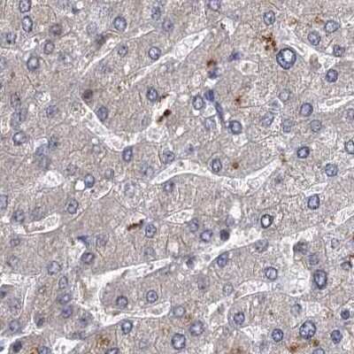 Immunohistochemistry-Paraffin: S5a/Angiocidin Antibody [NBP1-90821]