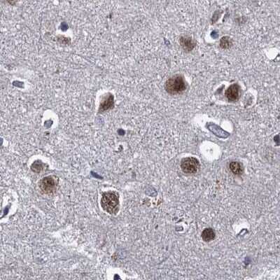 Immunohistochemistry-Paraffin: S5a/Angiocidin Antibody [NBP1-90821]