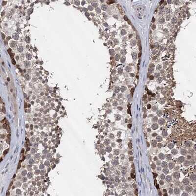Immunohistochemistry-Paraffin: S5a/Angiocidin Antibody [NBP2-37888]