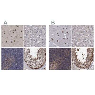 Immunohistochemistry-Paraffin: S5a/Angiocidin Antibody [NBP2-37888]