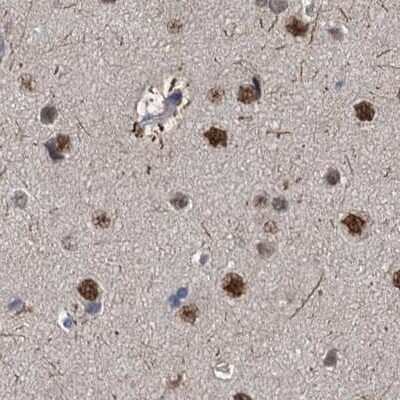 Immunohistochemistry-Paraffin: S5a/Angiocidin Antibody [NBP2-37888]