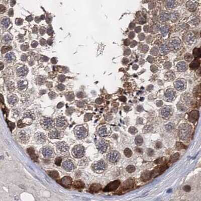 Immunohistochemistry-Paraffin: S5a/Angiocidin Antibody [NBP2-37888]