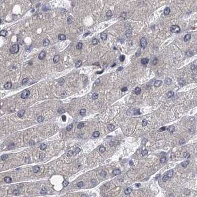 Immunohistochemistry-Paraffin: S5a/Angiocidin Antibody [NBP2-37888]