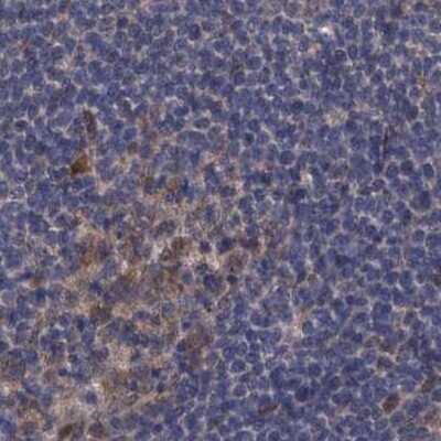 Immunohistochemistry-Paraffin: S5a/Angiocidin Antibody [NBP2-37888]