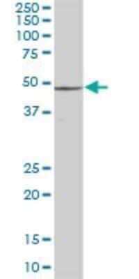 Western Blot: S5a/Angiocidin Antibody [H00005710-B01P]