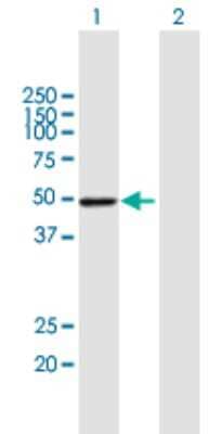 Western Blot: S5a/Angiocidin Antibody [H00005710-B01P]